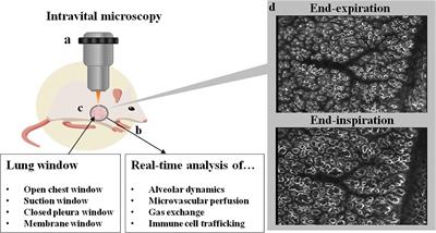 Ventilation and Perfusion at the Alveolar Level: Insights From Lung Intravital Microscopy